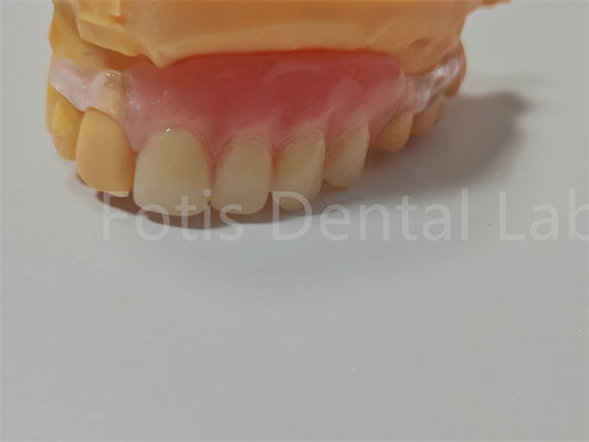 Сертификация FDA/ISO TCS Valplast Гибкие зубные протезы легко чистить и регулировать
